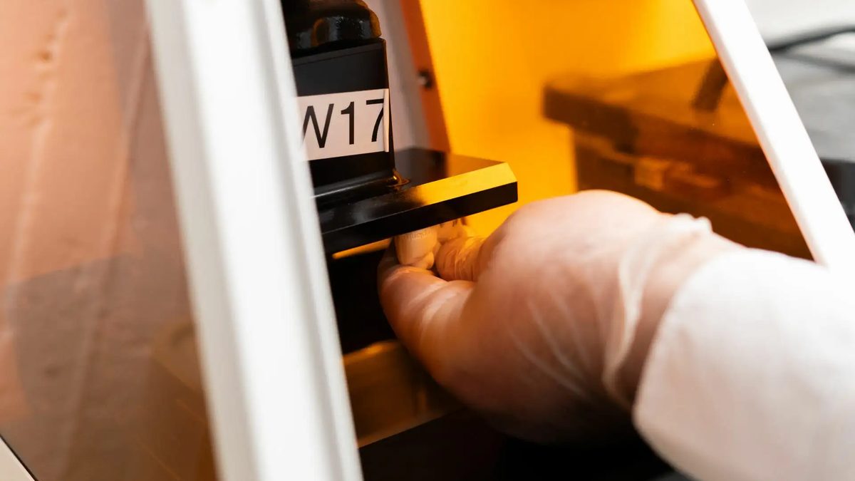 Gedruckte Zahnschiene wird aus dem 3D-Drucker genommen
